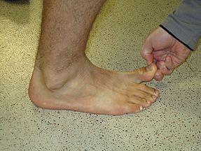 dorsiflexion